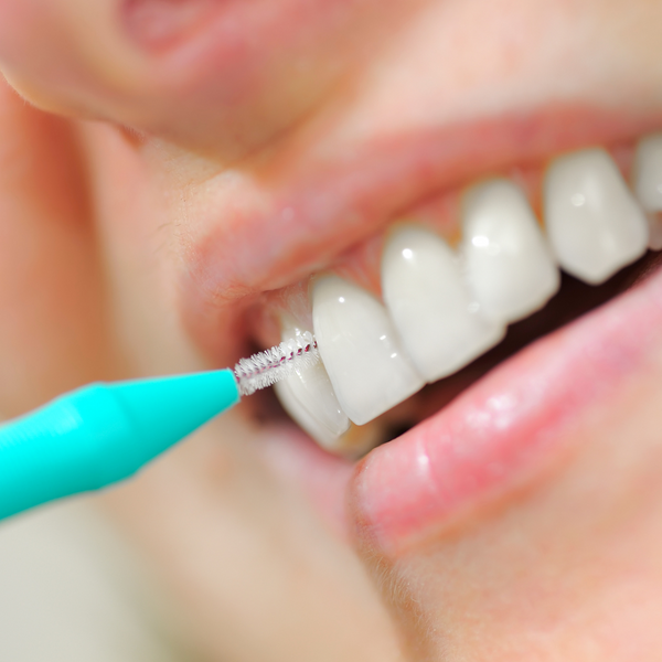Why Cleaning in Between Your Teeth is Crucial for a Healthy Smile