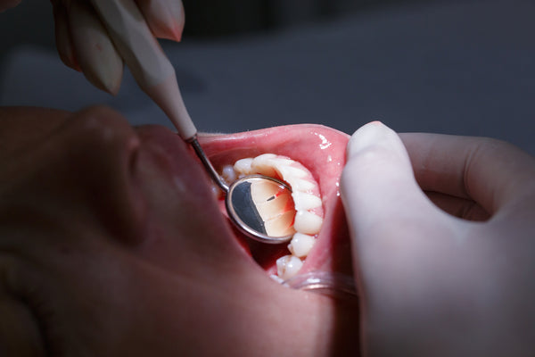 5 Ways To Prevent Receding Gums