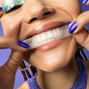 Smilepen Pop Teeth Whitening Strips