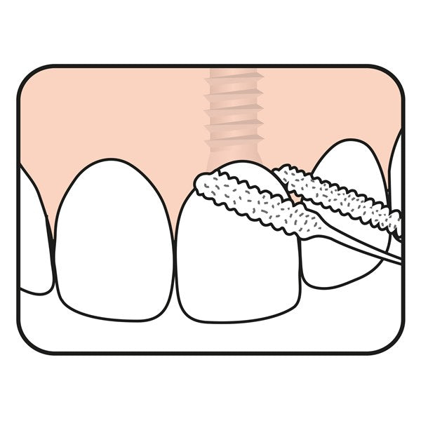 TePe Bridge & Implant Floss - Floss | SmileShop , Bridge, Floss, Super, Super Floss