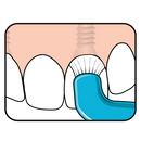 TePe Compact Tuft  1xBrush - Speciality Brush | SmileShop , Compact, Implant, Speciality Brush, TePe, Tuft